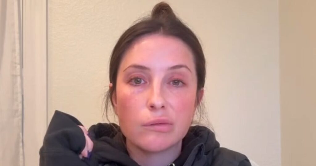 Bristol Palin Is 'Starting' to Feel Sensation After Facial Paralysis