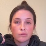 Bristol Palin Is 'Starting' to Feel Sensation After Facial Paralysis