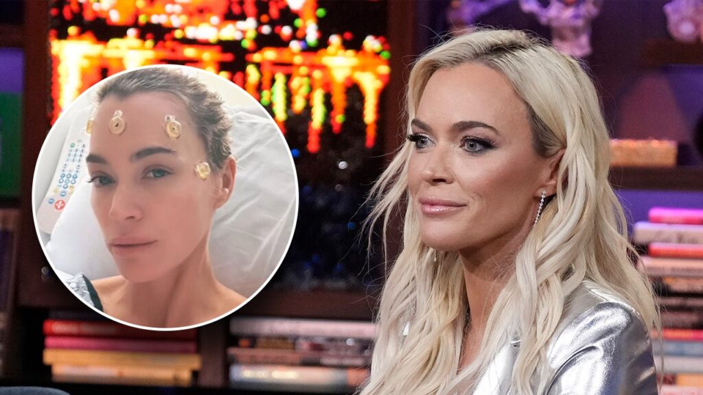 Teddi Mellencamp, 'Real Housewives' alum, updates fans after undergoing brain surgery