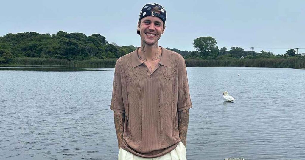 How Justin Bieber Is Really Coping After Those 'Strange' Photos