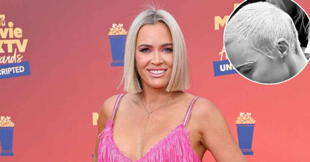 Teddi Mellencamp Has Staples Removed After Brain Tumor Surgery