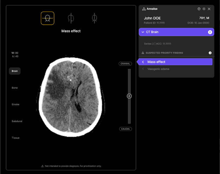 Australian health tech startup Harrison.ai scores $112M Series C