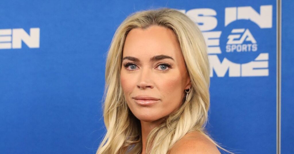 Teddi Mellencamp Has Multiple Brain Tumors, Is Undergoing Surgery