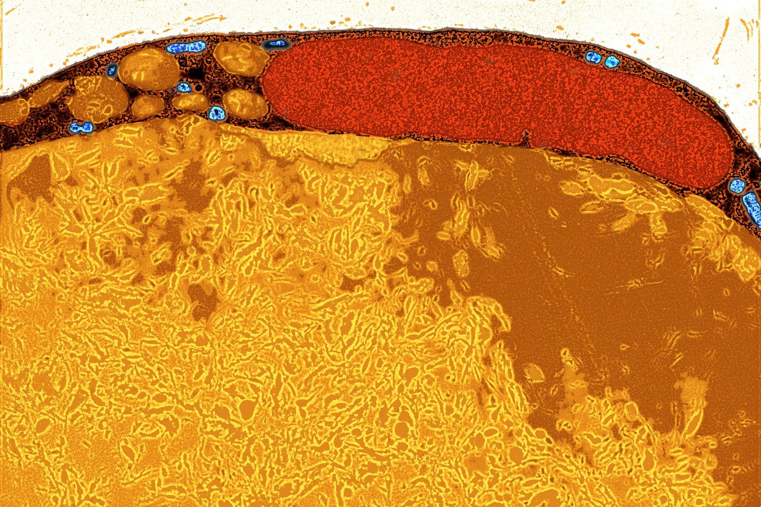 A close-up of a fat cell taken via transmission electron microscopy.