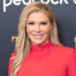 Brandi Glanville Says Her 'Face is Worse Than Ever': 'Melted Away'