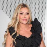 Everything Brandi Glanville Has Said About Her Facial Disfigurement