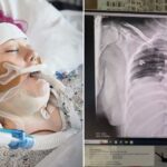 ‘I vaped for one year and almost died’